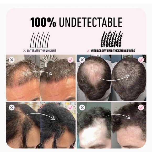 Boldify Hair Thickening - Picture 4 of 7